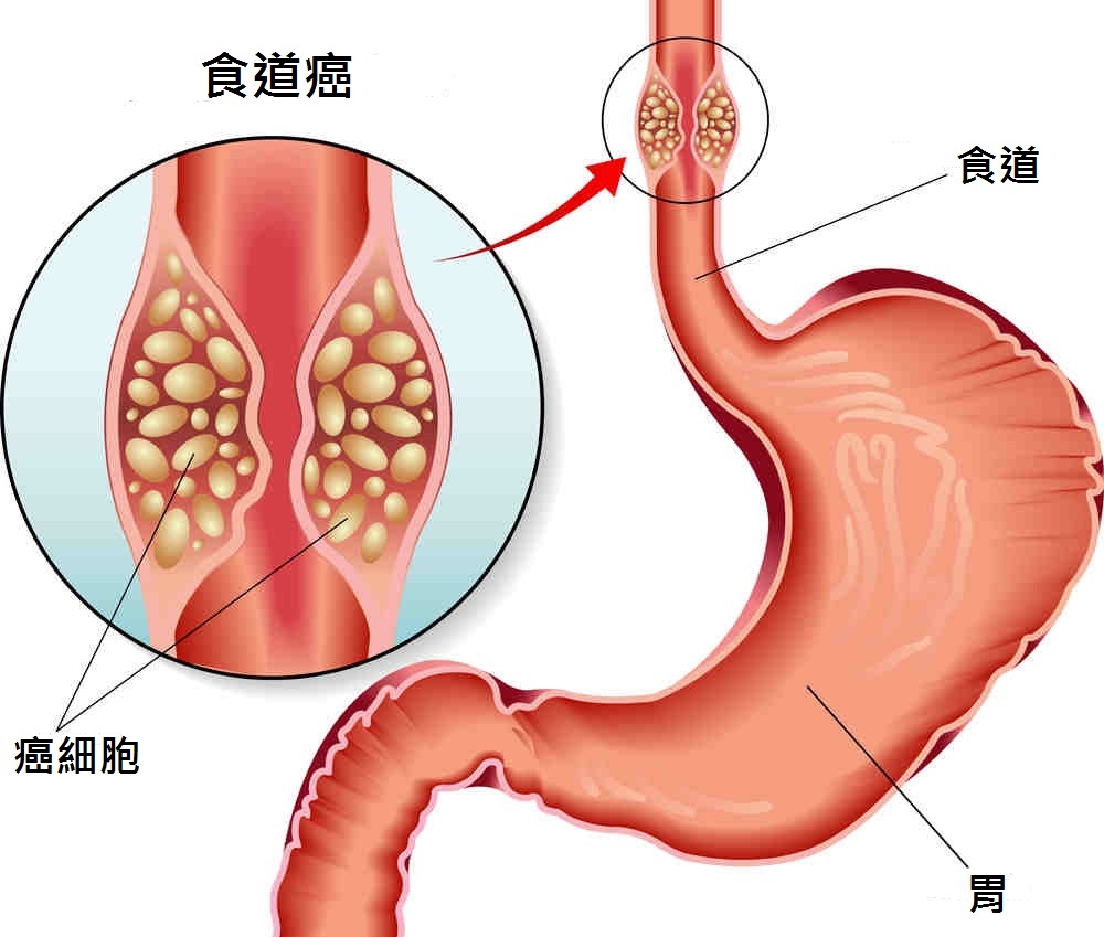 食道图片高清