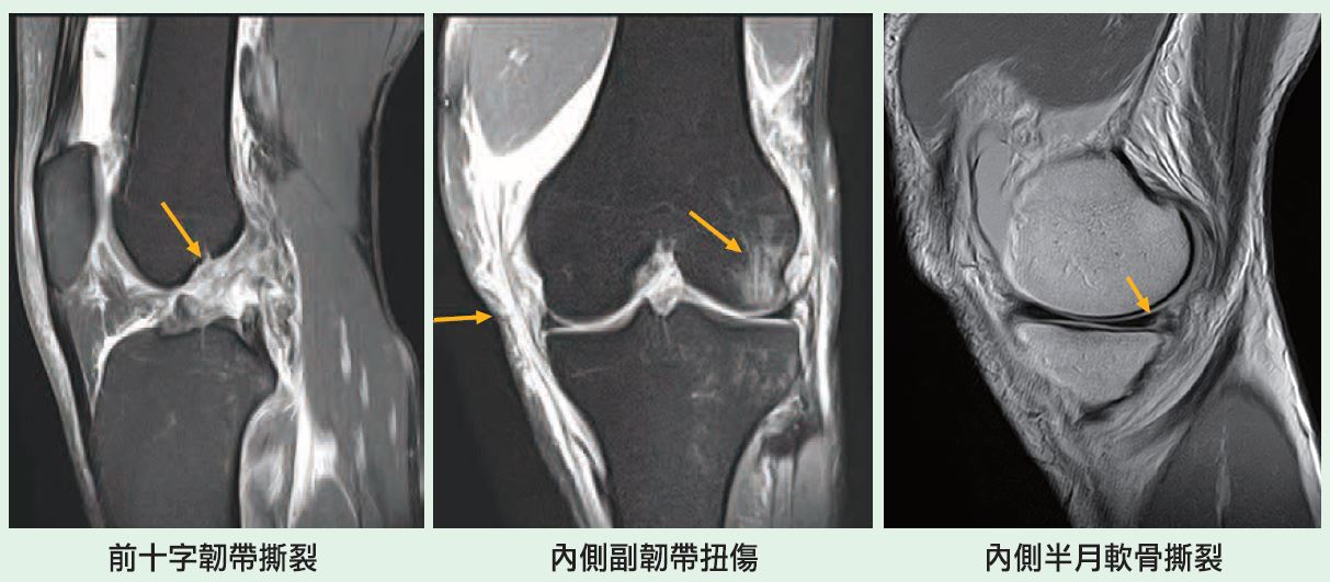 影像學大不同透視骨關節肌肉助診斷 永越健康管理中心