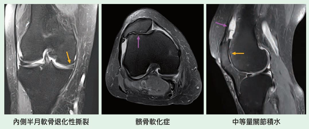 影像學大不同透視骨關節肌肉助診斷 永越健康管理中心